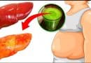 Como Tratar a Gordura no Fígado